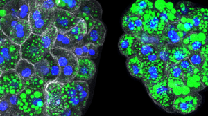 Liver organoid