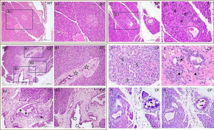 Representative histological sections of the pancreas of rabbits with cystic fibrosis (CF).