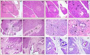 Representative histological sections of the pancreas of rabbits with cystic fibrosis (CF).