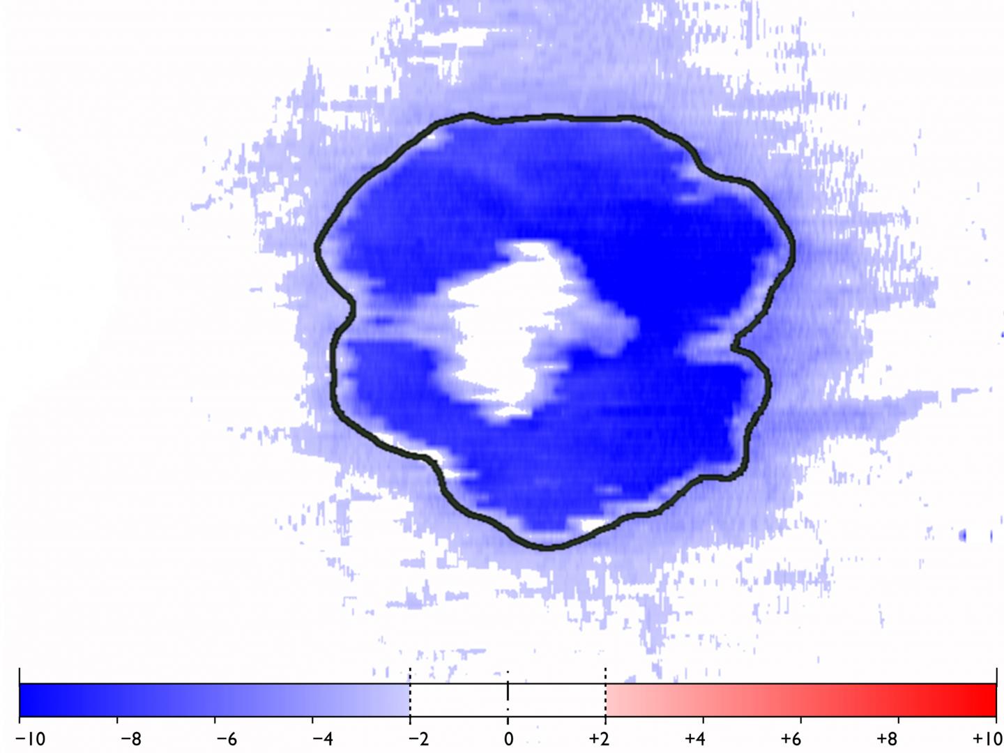 Thickness of the outer nuclear layer