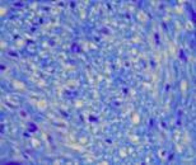 Sky Blue Staining, Myelin Sheath