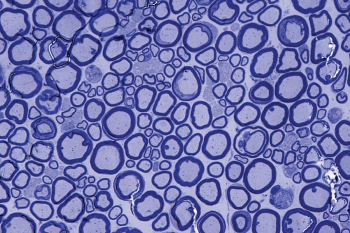 Beneficial Role Clarified for Brain Protein Associated with Mad Cow Disease