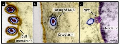 Electron Micrograph of HSV-1 Infecting a Cell