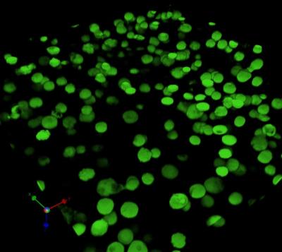 Mesenchymal Stem Cells