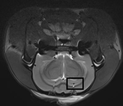 MRI T2-weighted Images