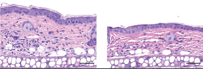 SYM2081 reduces skin swelling