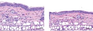 SYM2081 reduces skin swelling