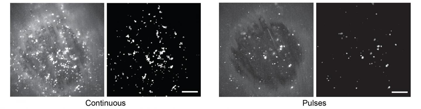 Activation of Striatal Neurons with Patterned Stimulation