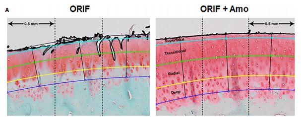 Can Interrupting a Cell's Power Source After Injury Protect Against Post-Traumatic Osteoarthritis? (1 of 3)