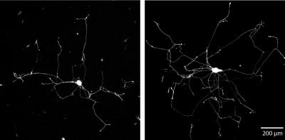 Neurons Develop More Branched Growth in Experiment (2 of 2)