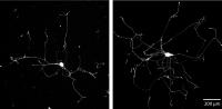 Neurons Develop More Branched Growth in Experiment (2 of 2)