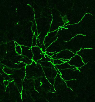 Thalamic Neuron