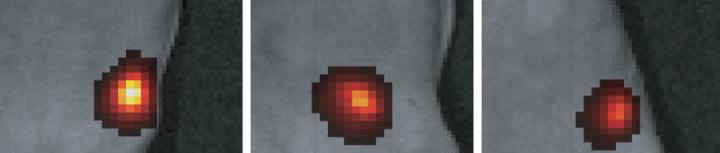 Imaging Through Living Tissue