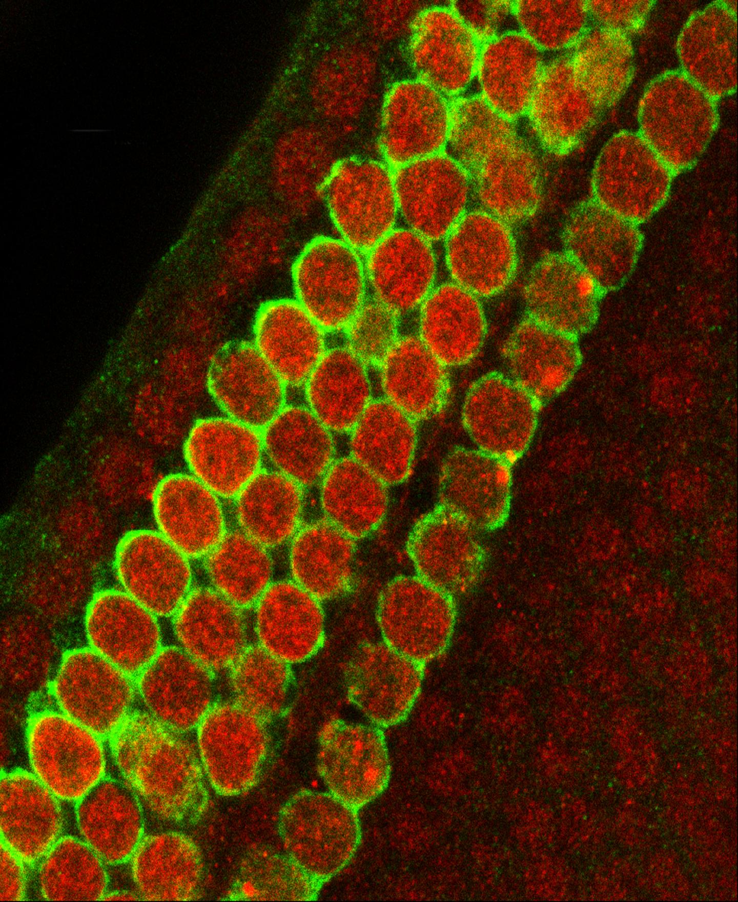Sensory Hearing Cells