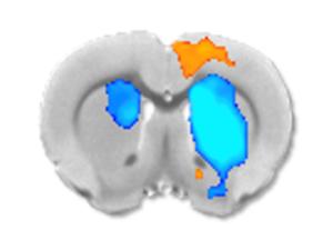 fMRI of rat striatum