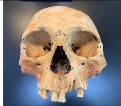 Study of Skulls Changes Understanding of Caribbean