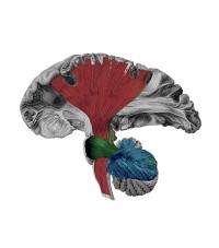 Motor White Matter Networks of the Human Brain
