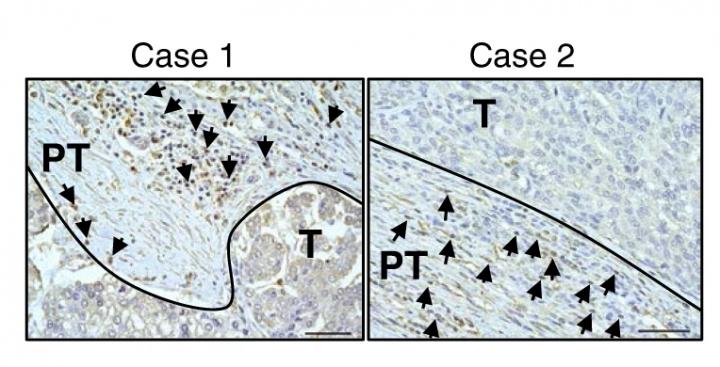 Immunohistochemical Staining