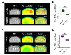 Figure 2. 11C-acetate uptake is blocked by MAO-B inhibitor and MCT1 gene silencing in the patient-derived glioblastoma mice model (PDX mice model)