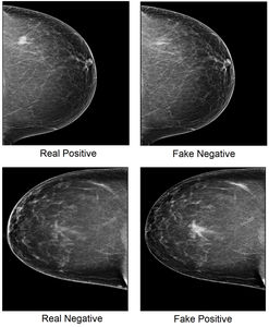 Examples of real and fake mammogram images.