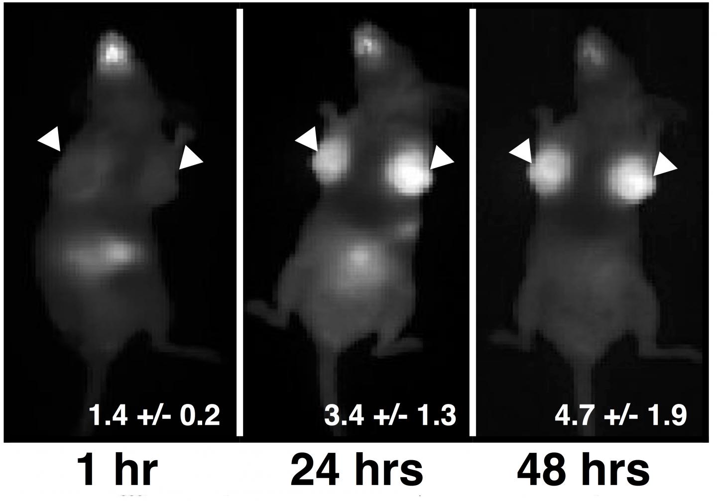 Lighting Up Cancer Cells