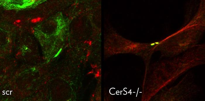 Co-localization of tbr1 Receptor in Primary Cilia of Two Adjacent Cells in cers4-/- Mammary Tumor Ce