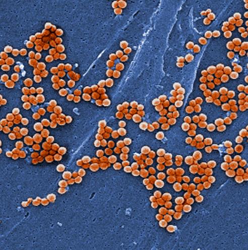 Scanning Electron Micrograph (SEM) of Methicillin-Resistant <i>Staphylococcus aureus</i> (MRSA)