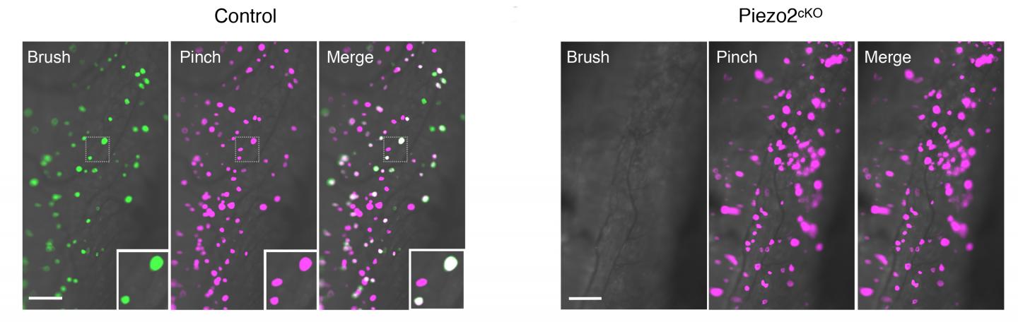 Scientists Get in Touch with the Biology Underlying Pain