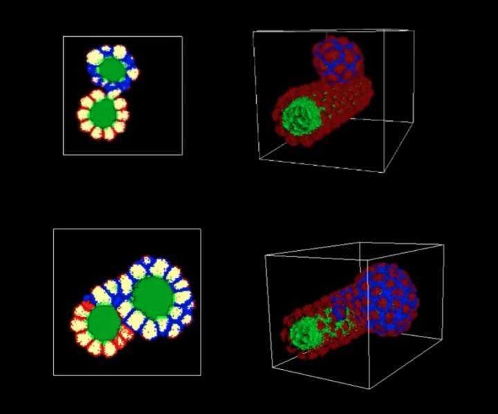 Kidney Cyst Formation