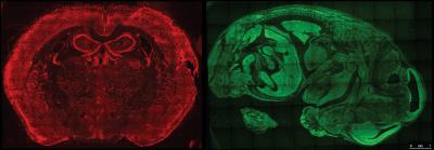 Mouse Embryo and Brain