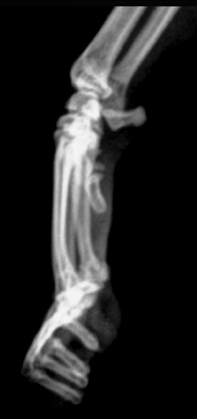 Radiograph