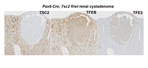 Murine renal tumors