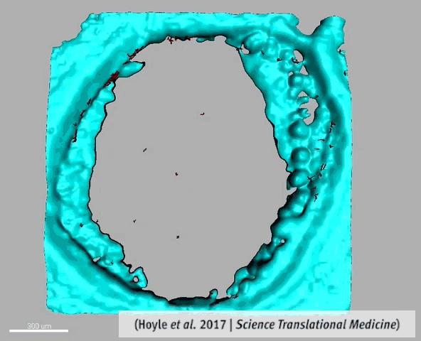 Wound Healing Guided by Cellular Clock (6 of 9)