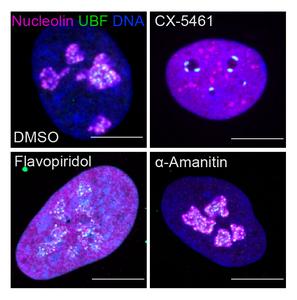 Fluorescent images showing nucleolar stress induced by drugs that inhibit transcriptional enzymes