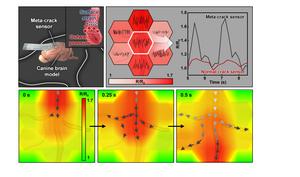 ▲ Figure 3 (Top, Left) Schematic illustration of biomechanical signal monitoring on the vascular surface of a canine brain model. (Top, Right) Hypersensitive monitoring of blood pressure changes on the vascular bundle surface. (Bottom) Real-time monitor