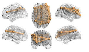 Brain networks