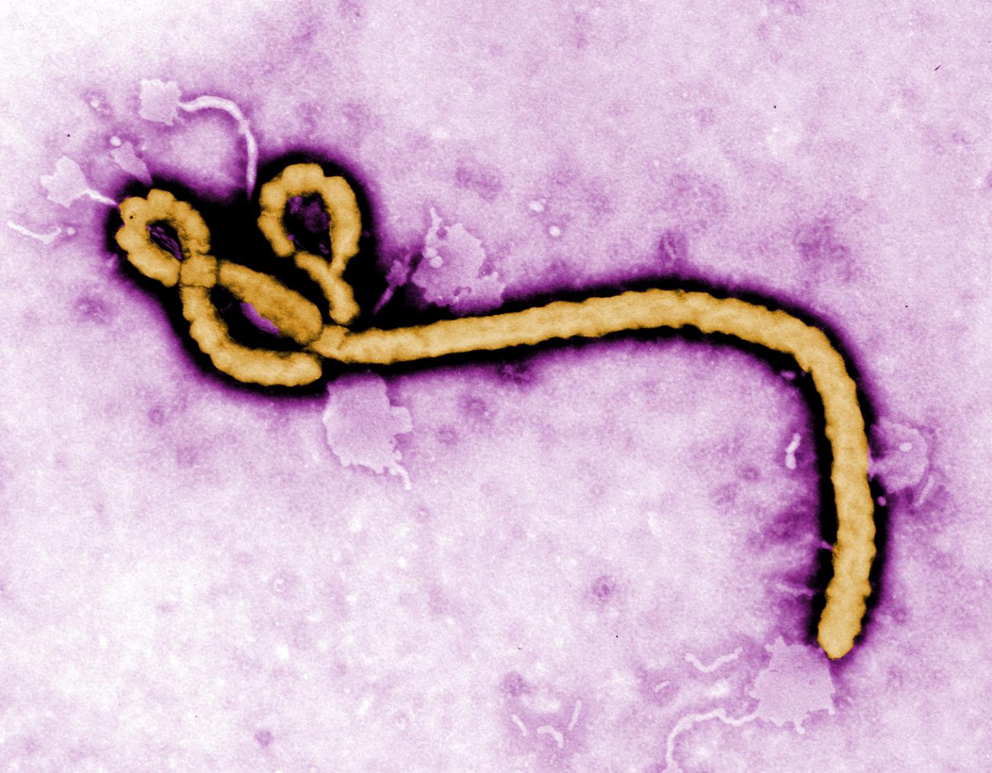 Ebola Virion