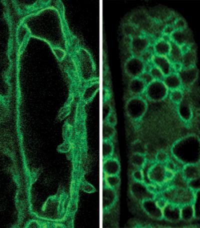 Vacuoles in Wild-Type and Mutant Plant Cells