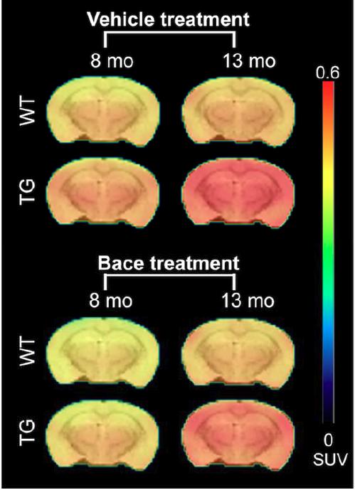 Longitudinal PET Imaging with 18F-AV45