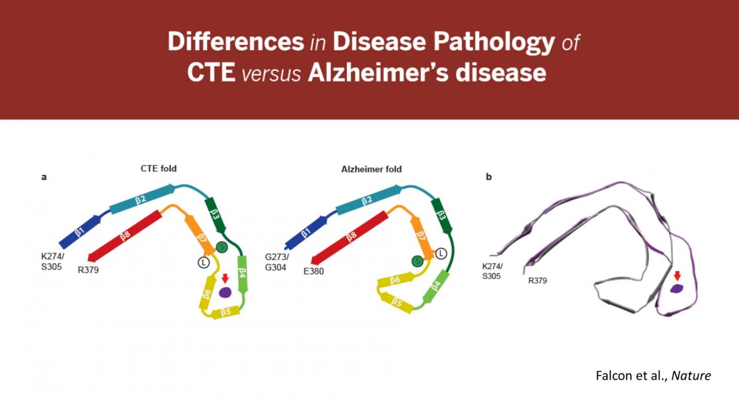 Difference in Disease Pathology of CTE versus Alzheimer's Disease