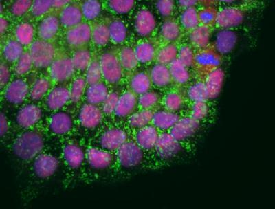 The Goldilocks Effect in Aging Research