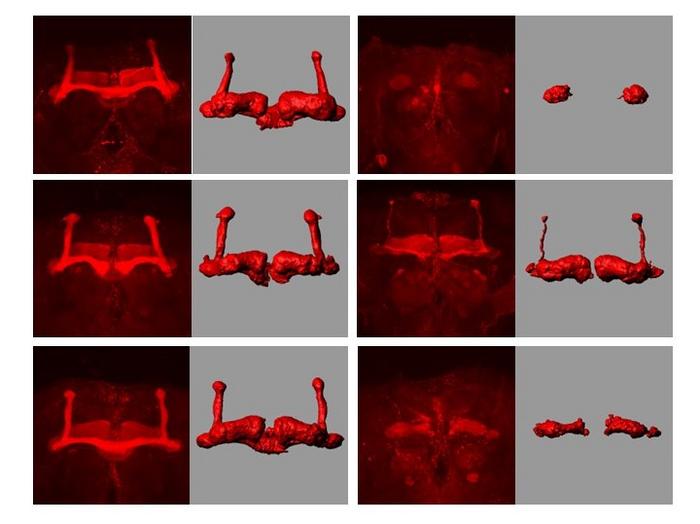 Morphology of the mushroom body of the FTLD (frontotemporal lobar degeneration) model fruit flies.