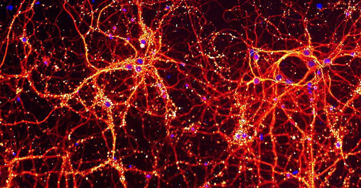 Neurons grown in the laboratory