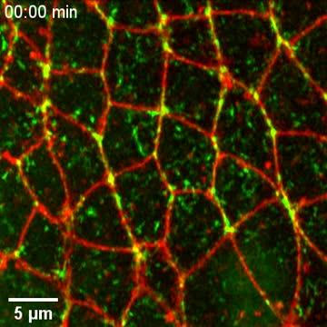 Confocal Microscope Movie of Mutant Myosin II in Cells of the Developing Fruit Fly Embryo
