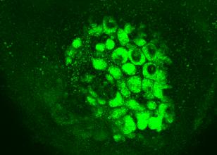 Stem Cell-Derived Kidneys Connect to Blood Vessels when Transplanted into Mice