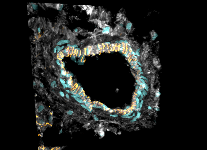 Cross section of an artery of the heart