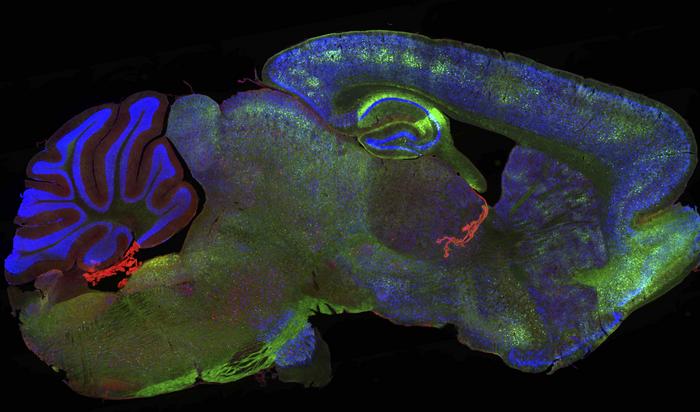 Mouse brain treated with RING-Bait