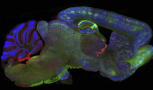 Mouse brain treated with RING-Bait