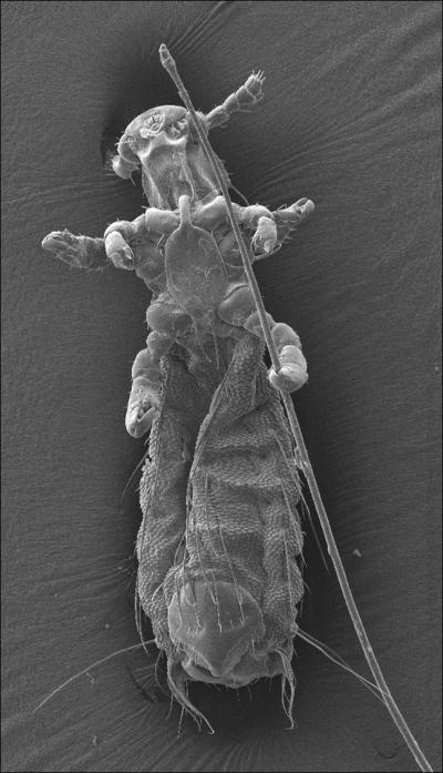 Parasitic Louse Lemurpediculus verruculosus