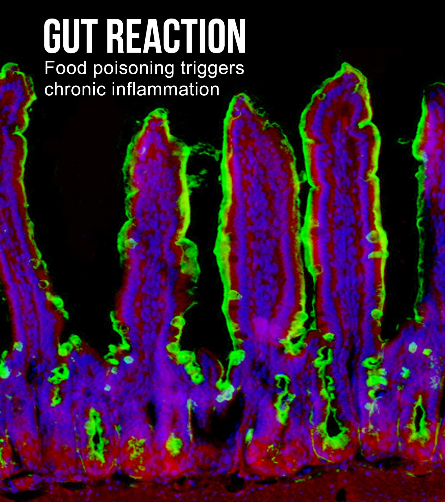 Food Poisoning Trigger Chronic Inflammation